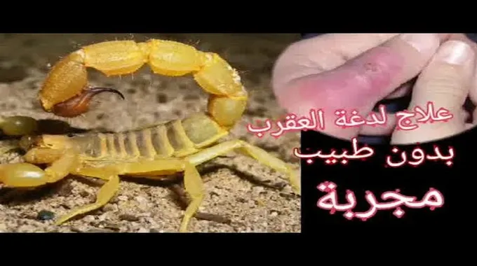 ما هو علاج لدغة العقرب؟